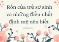 Rốn của trẻ sơ sinh và những điều mẹ phải biết